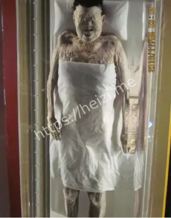 马王堆辛追遗体